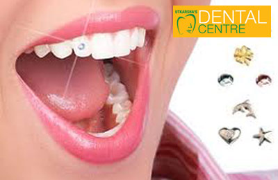 Rs. 99 to avail upto 75% off on various dental services 		        				        			View Rate Card