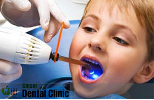 Chisel Dental Clinic