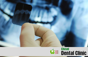 Chisel Dental Clinic