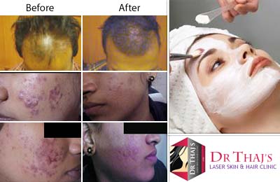 Dr Thaj's Laser Skin & Hair Clinic