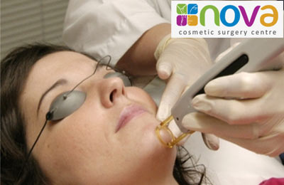 Rs. 99 gets you laser hair removal worth Rs. 3000 at Nova Cosmetic Surgery Centre