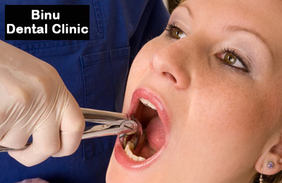 Rs 99 for dental services & consultation worth Rs 1550 at Binu Dental Clinic