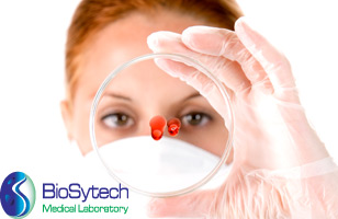 Rs. 299 for complete Executive Health Check Up worth Rs. 2300 