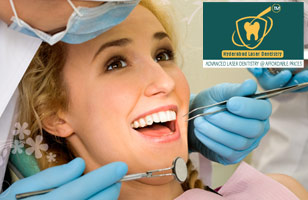 Rs. 200 for consultation, scaling and RVG worth Rs. 750 at Hyderabad Laser Dentistry