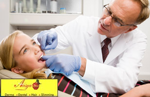 Rs 199 to avail dental consultation, scaling, polishing and x-ray worth Rs 1300