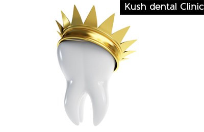 Kush Dental Clinic